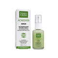 Martiderm Acniover Serum 30ml - Derma y Laser Boutique
